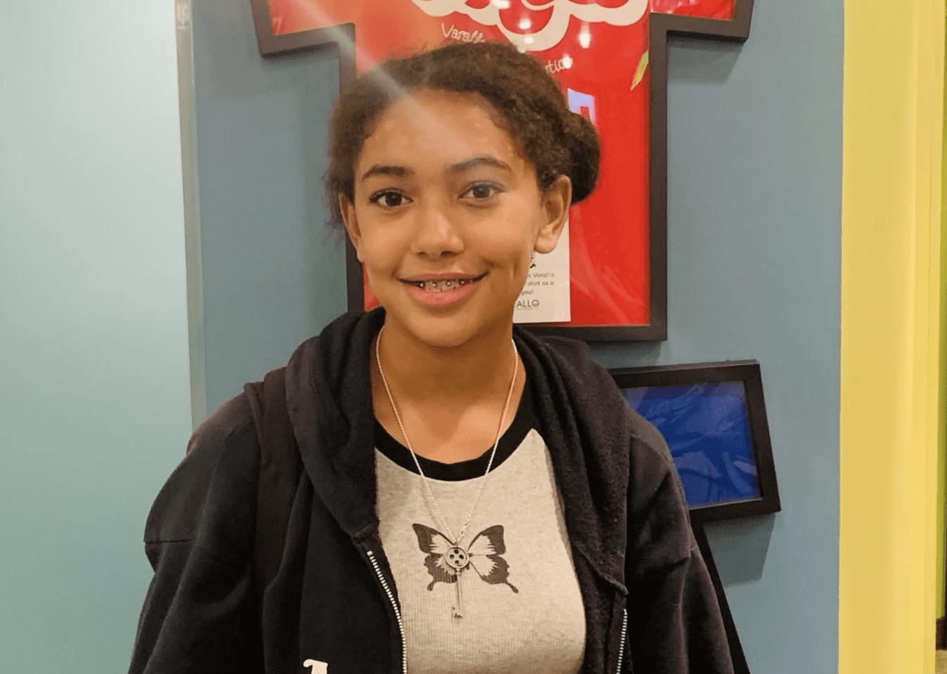 What Factors Determine How Long I'll Need to Wear Braces?