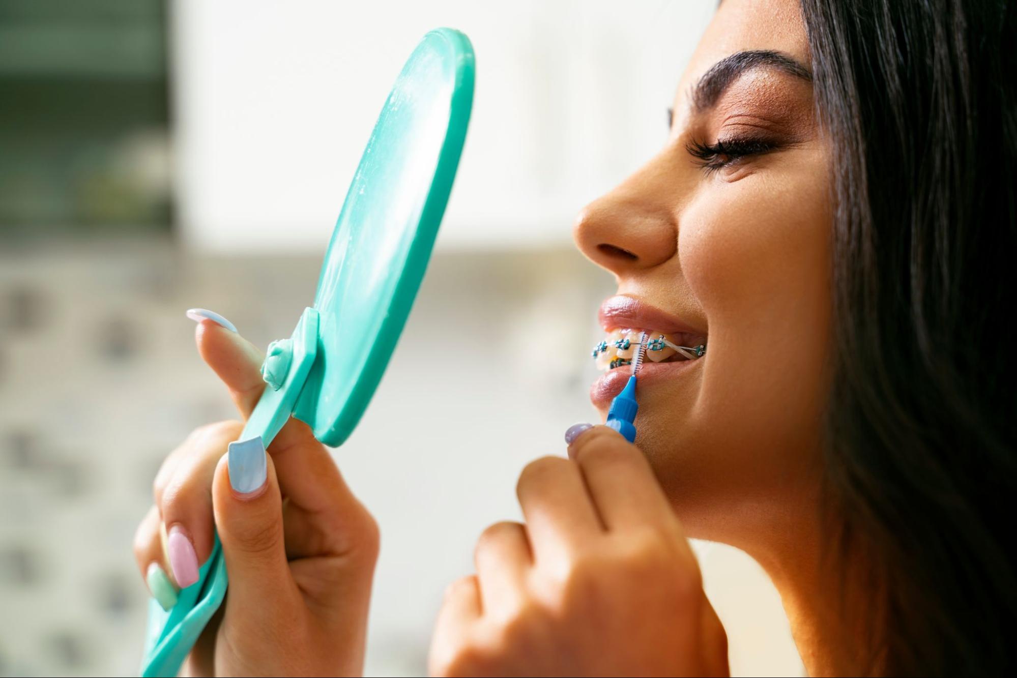 How To Care for Your Smile After Braces